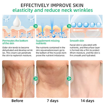 Wrinkle Removal Cream